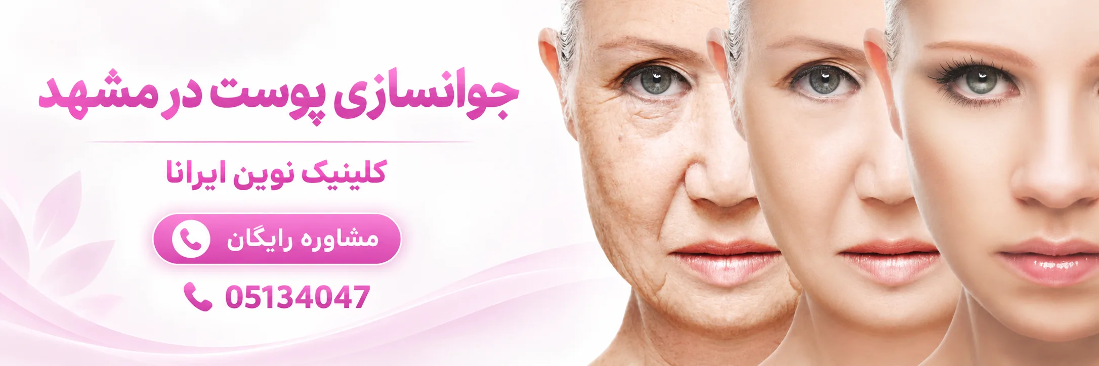 جوانسازی پوست در کلینیک نوین ایرانا